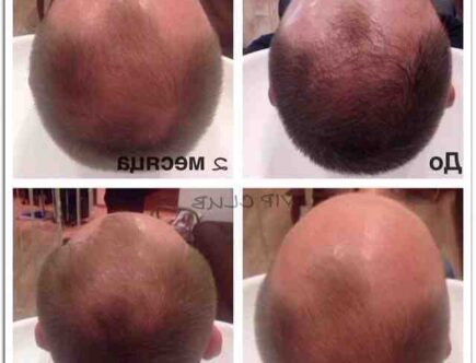 Avis l'oréal serioxyl denser hair