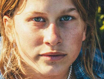 Comment faire pour avoir des taches de rousseur au soleil ?
