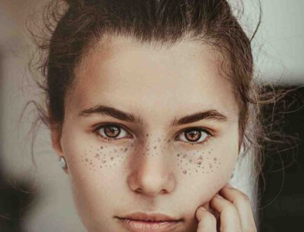 Comment faire revenir ses taches de rousseur ?