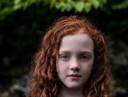 Quand apparaissent les taches de rousseur ?