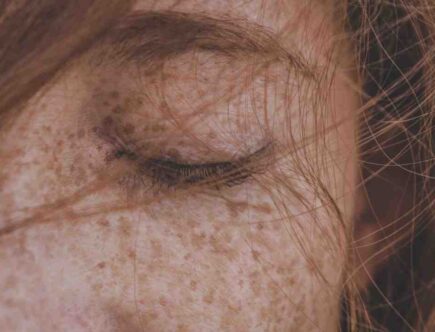Qui peut avoir des taches de rousseur ?