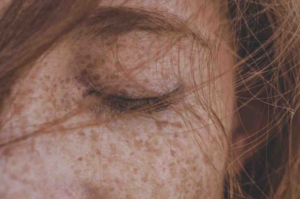 C'est quoi des taches de rousseur ? - Passion Makeup