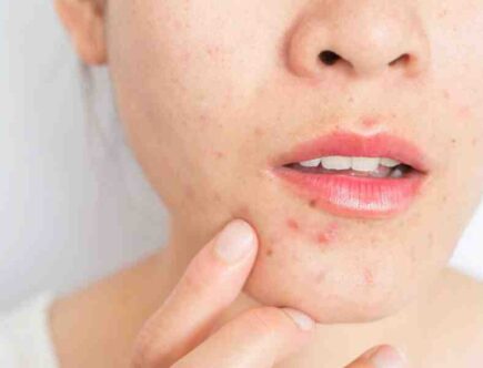 Quand utiliser un exfoliant ?