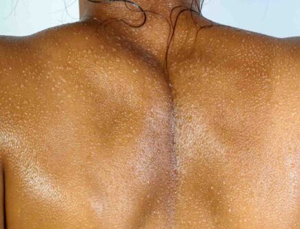 Comment faire une crème pour peau sèche ?