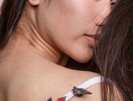 Comment Regenerer la peau après brûlure ?