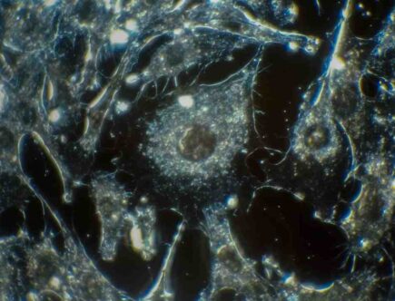 Comment rajeunir les cellules ?