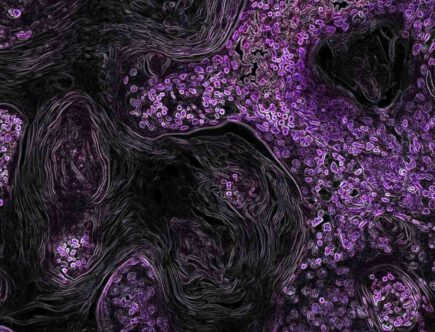 Comment régénérer les cellules ?
