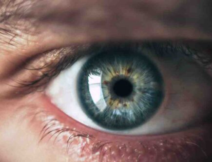 Quelle est la forme de mes yeux ?