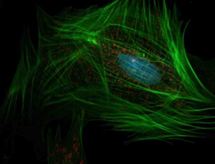 Quelles sont les cellules concernées par la mitose ?